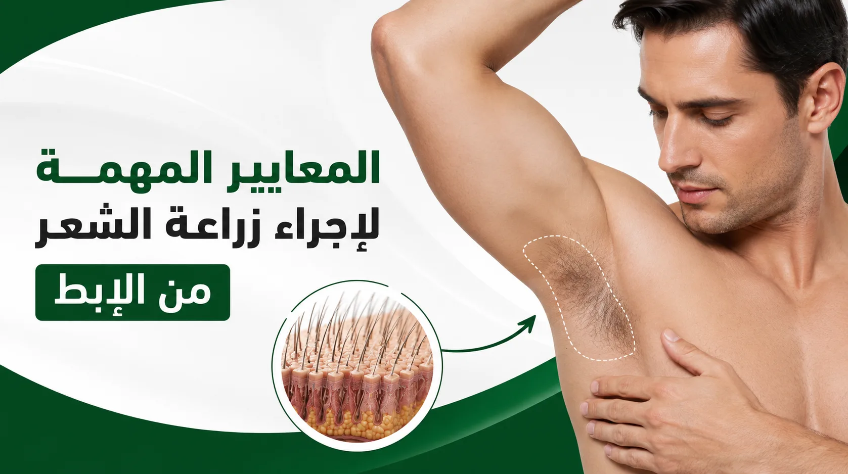 المعايير المهمة لإجراء زراعة الشعر من الإبط